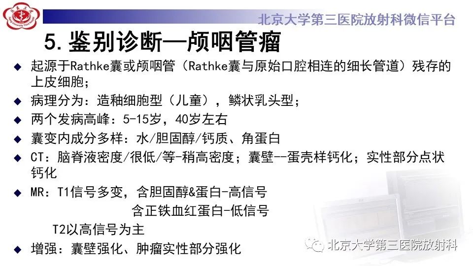 影像PPT - 【PPT】鞍旁表皮样囊肿/胆脂瘤-26
