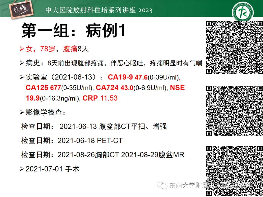 影像PPT - 【PPT】腹膜弥漫性病变-5