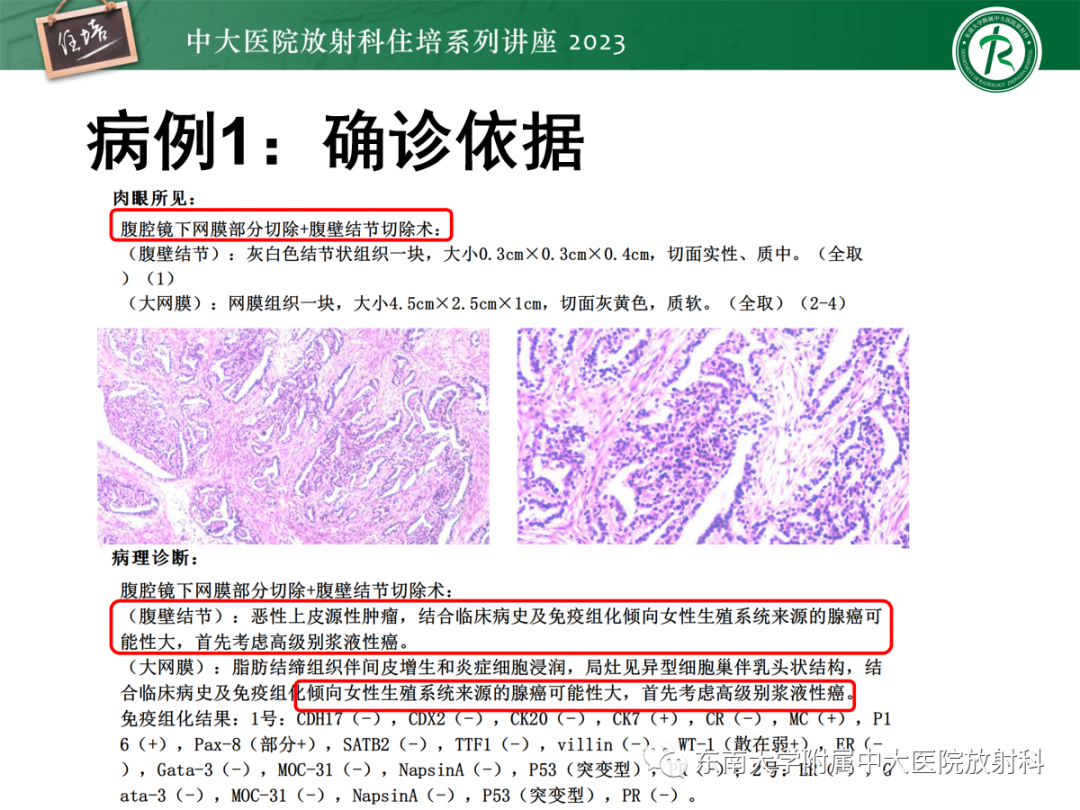 影像PPT - 【PPT】腹膜弥漫性病变-10