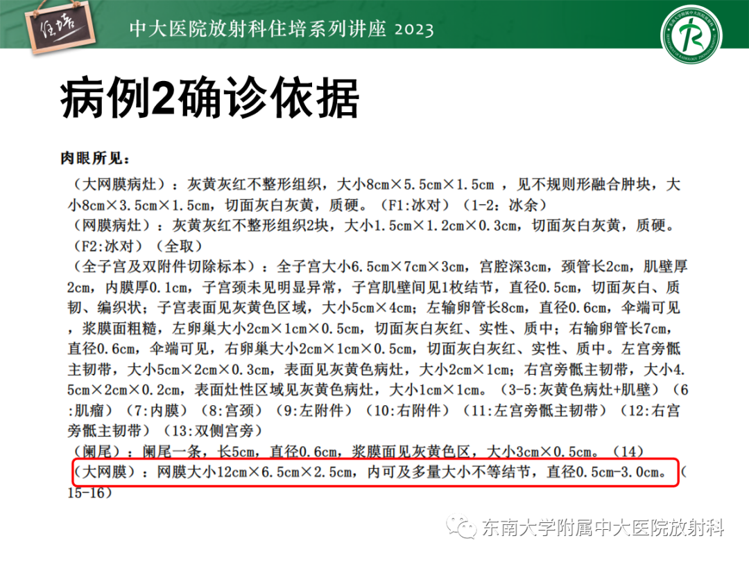 影像PPT - 【PPT】腹膜弥漫性病变-14