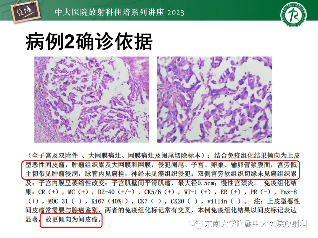影像PPT - 【PPT】腹膜弥漫性病变-15