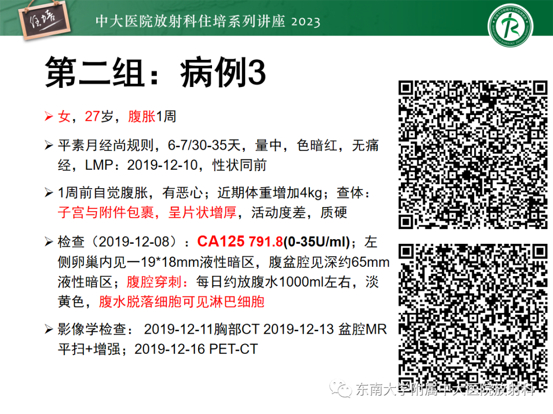 影像PPT - 【PPT】腹膜弥漫性病变-16