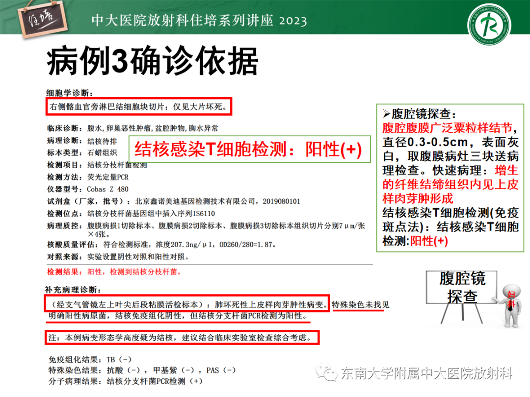 影像PPT - 【PPT】腹膜弥漫性病变-20