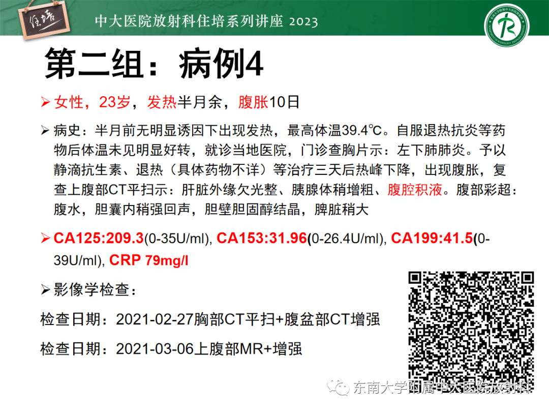 影像PPT - 【PPT】腹膜弥漫性病变-21