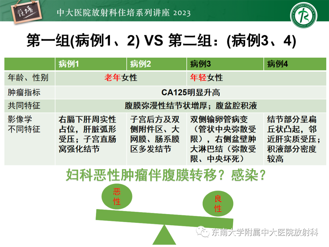影像PPT - 【PPT】腹膜弥漫性病变-24