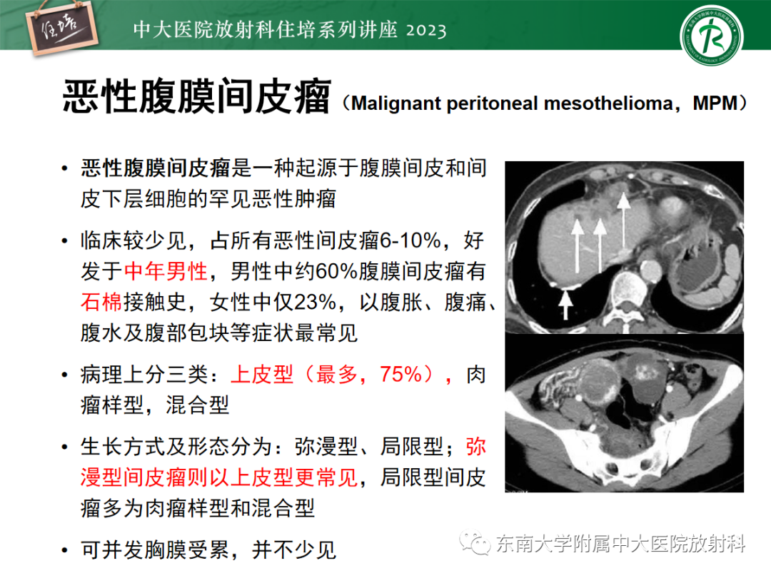 影像PPT - 【PPT】腹膜弥漫性病变-34