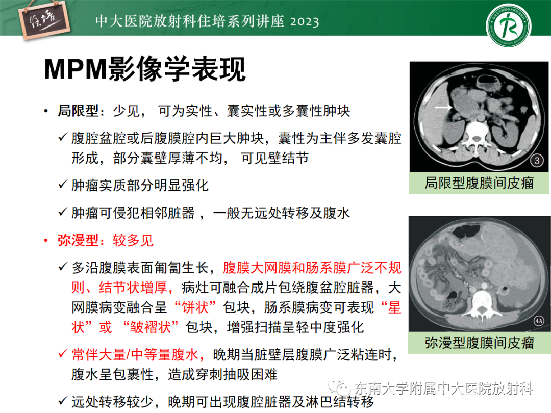 影像PPT - 【PPT】腹膜弥漫性病变-35