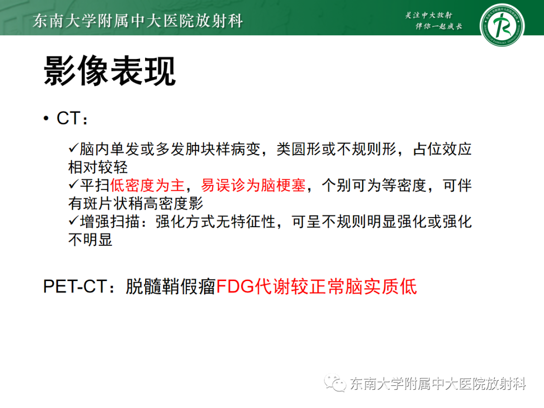 影像PPT - 【PPT】脱髓鞘假瘤-13 影像PPT - 【PPT】脱髓鞘假瘤-13