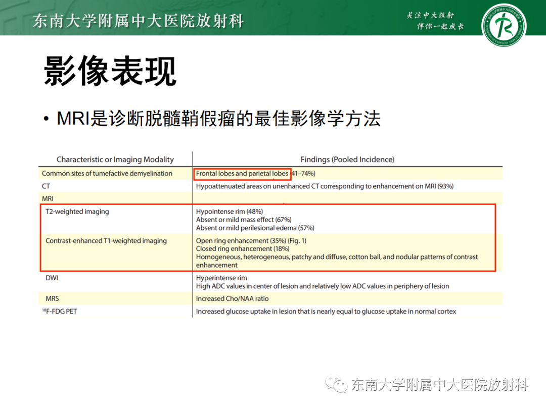 影像PPT - 【PPT】脱髓鞘假瘤-14 影像PPT - 【PPT】脱髓鞘假瘤-14