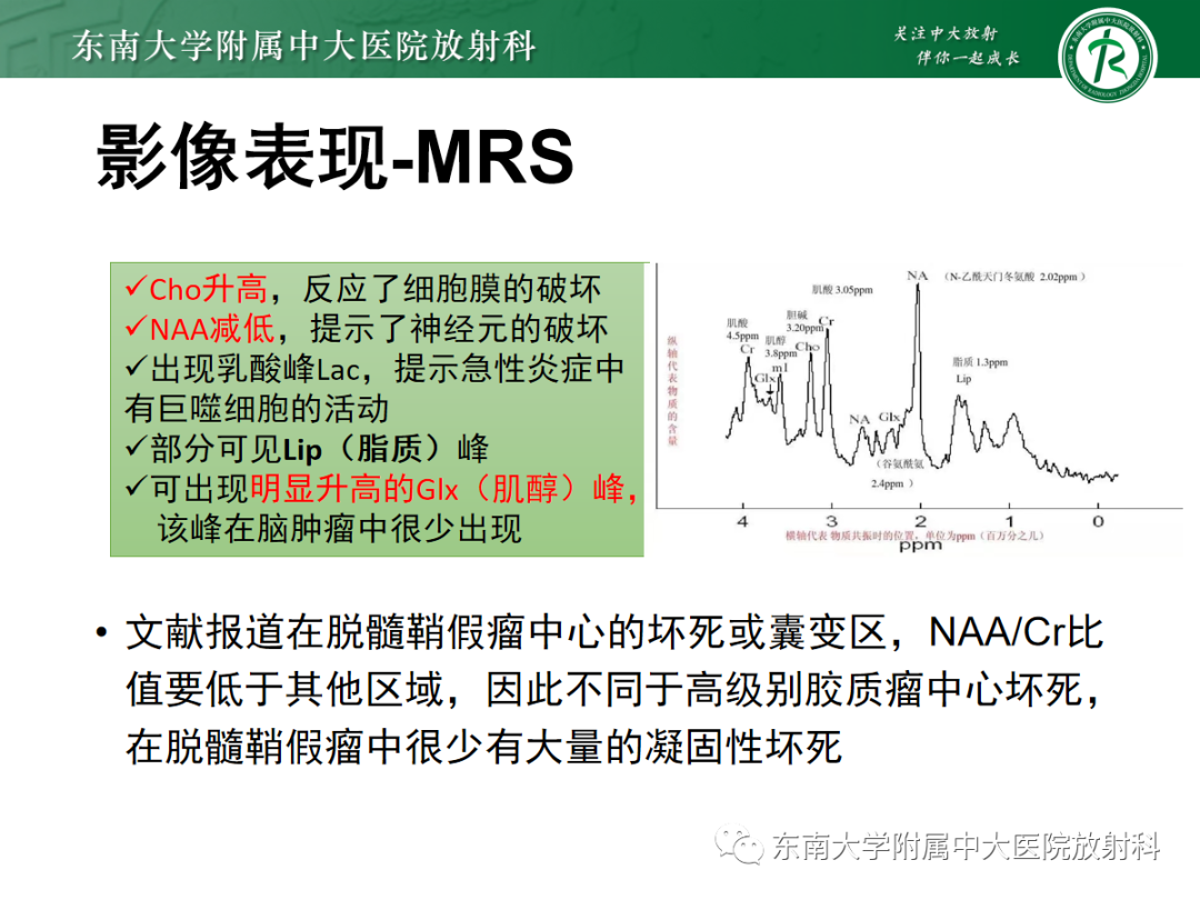 影像PPT - 【PPT】脱髓鞘假瘤-19 影像PPT - 【PPT】脱髓鞘假瘤-19