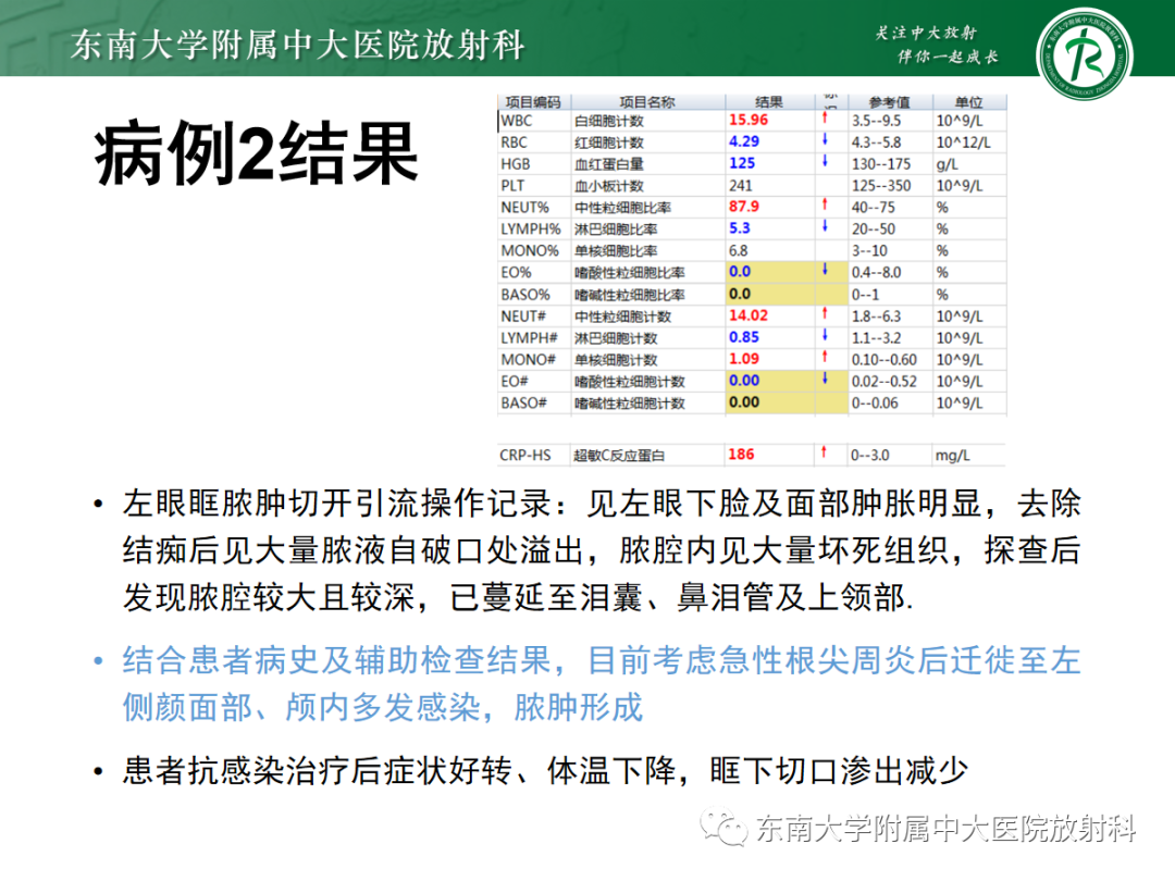 影像PPT - 【PPT】脱髓鞘假瘤-25 影像PPT - 【PPT】脱髓鞘假瘤-25