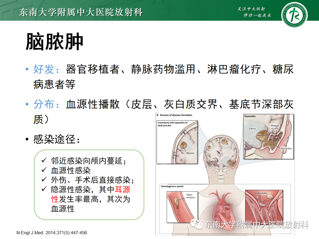 影像PPT - 【PPT】脱髓鞘假瘤-26 影像PPT - 【PPT】脱髓鞘假瘤-26