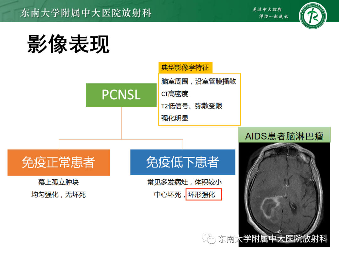 影像PPT - 【PPT】脱髓鞘假瘤-39 影像PPT - 【PPT】脱髓鞘假瘤-39