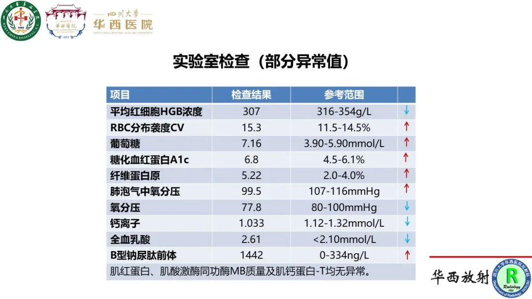 影像PPT - 【病例】心脏粘液瘤1例CT影像-3