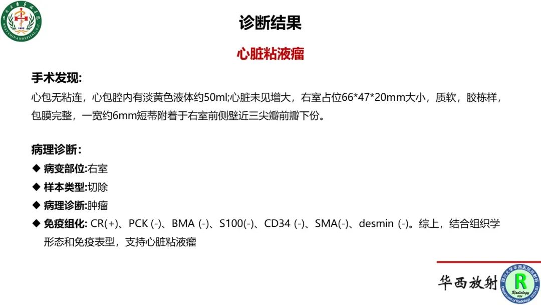 影像PPT - 【病例】心脏粘液瘤1例CT影像-11