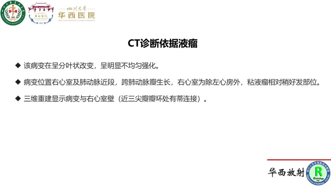 影像PPT - 【病例】心脏粘液瘤1例CT影像-12