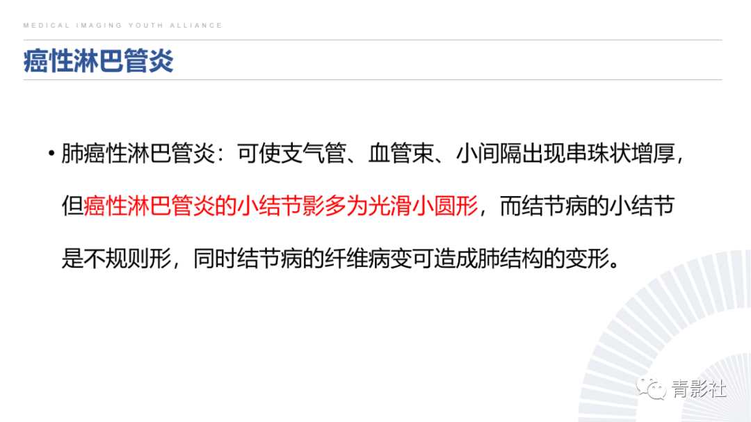 影像PPT - 【PPT】结节病的影像诊断思路-46