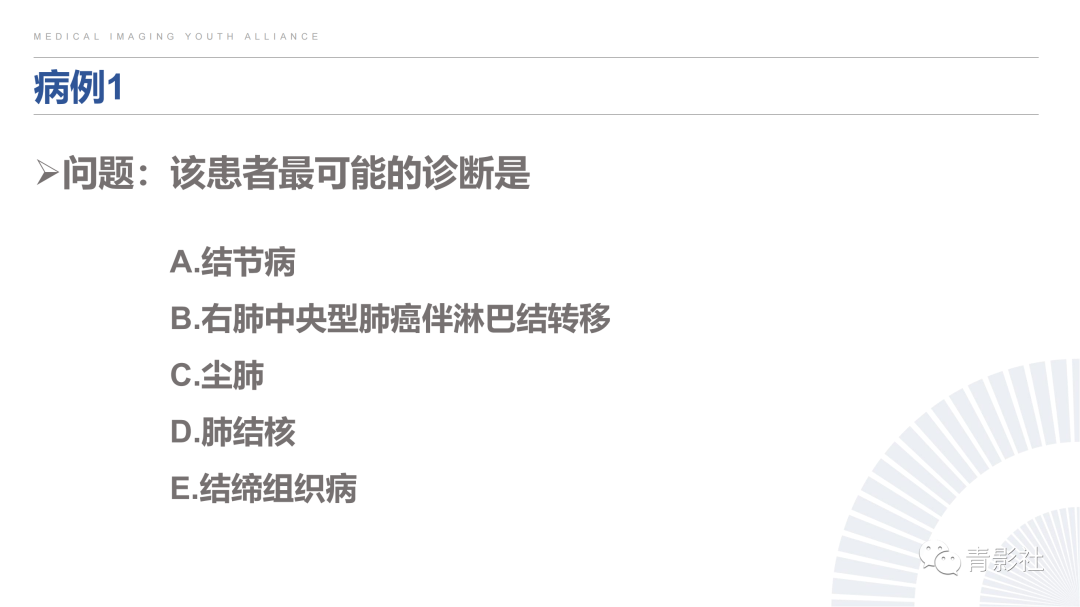 影像PPT - 【PPT】结节病的影像诊断思路-56