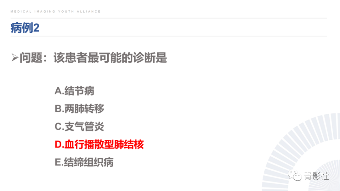 影像PPT - 【PPT】结节病的影像诊断思路-60