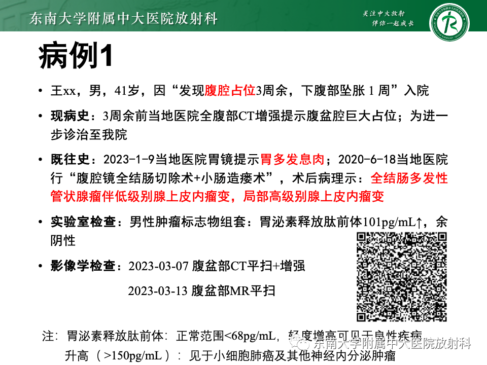影像PPT - 【PPT】肠系膜区占位病例随访-1