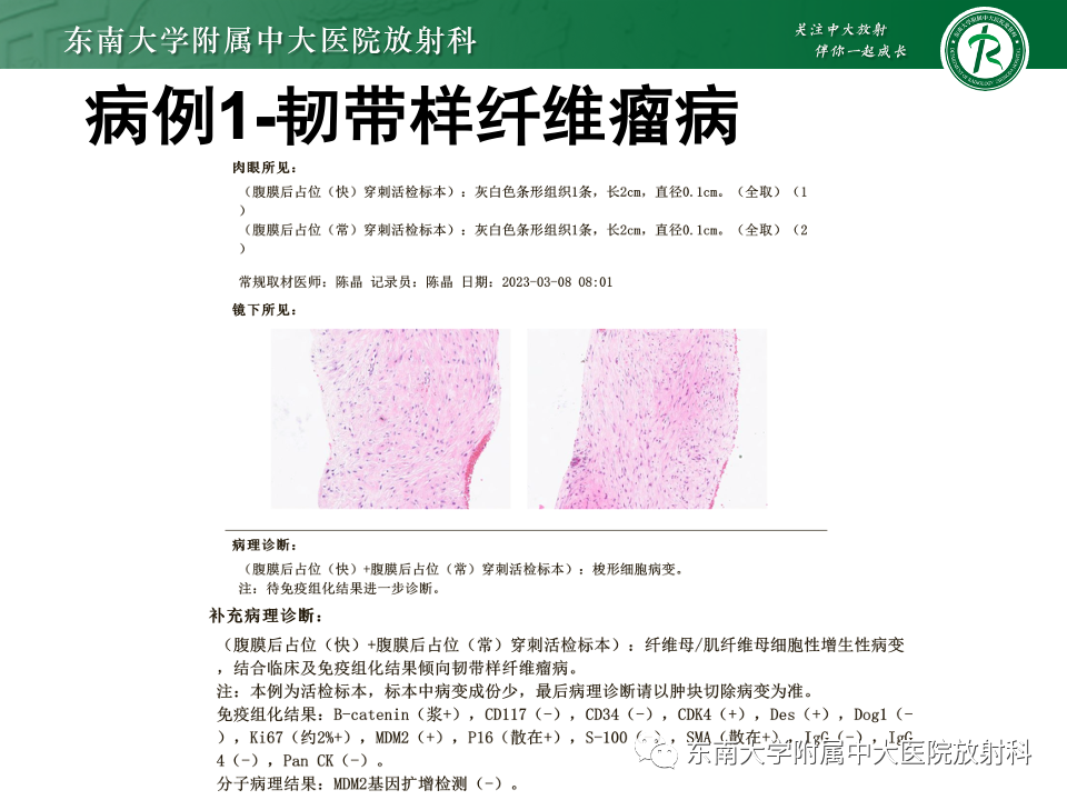 影像PPT - 【PPT】肠系膜区占位病例随访-10