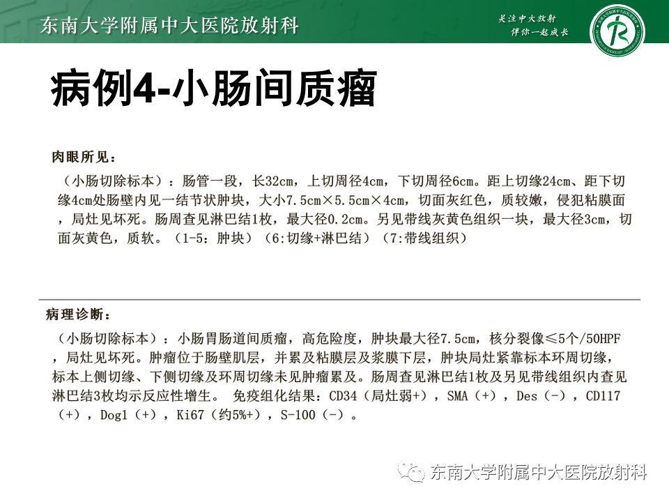 影像PPT - 【PPT】肠系膜区占位病例随访-13