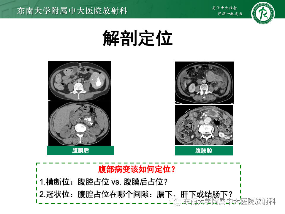 影像PPT - 【PPT】肠系膜区占位病例随访-20