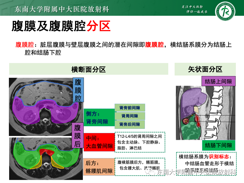 影像PPT - 【PPT】肠系膜区占位病例随访-21