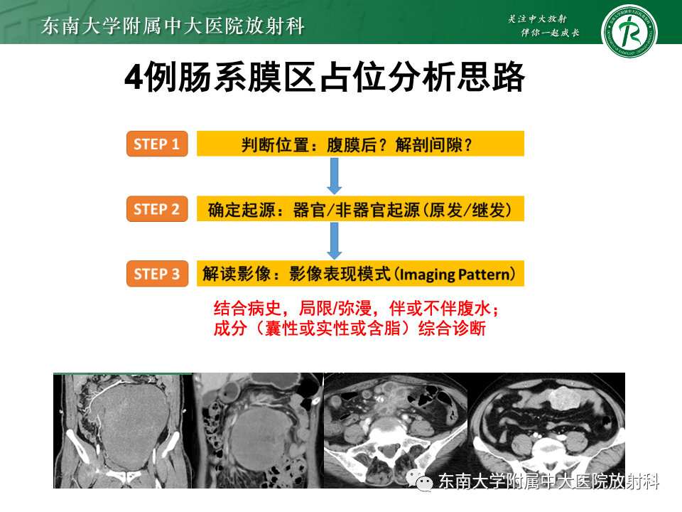 影像PPT - 【PPT】肠系膜区占位病例随访-23