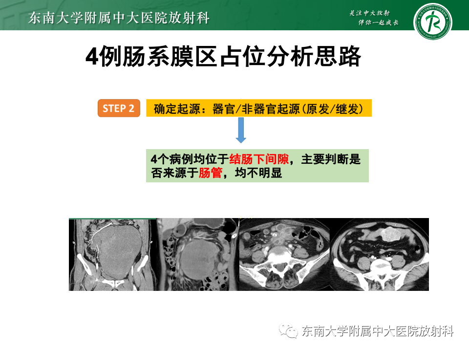 影像PPT - 【PPT】肠系膜区占位病例随访-25