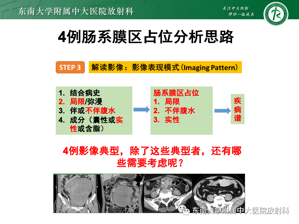 影像PPT - 【PPT】肠系膜区占位病例随访-26
