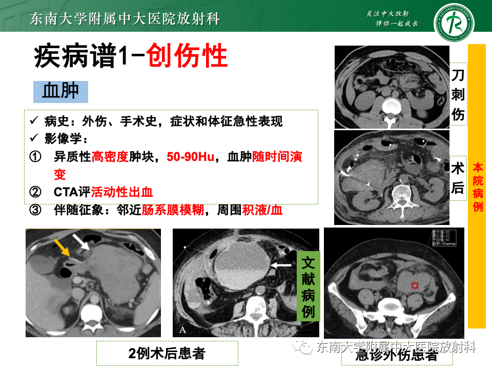 影像PPT - 【PPT】肠系膜区占位病例随访-29