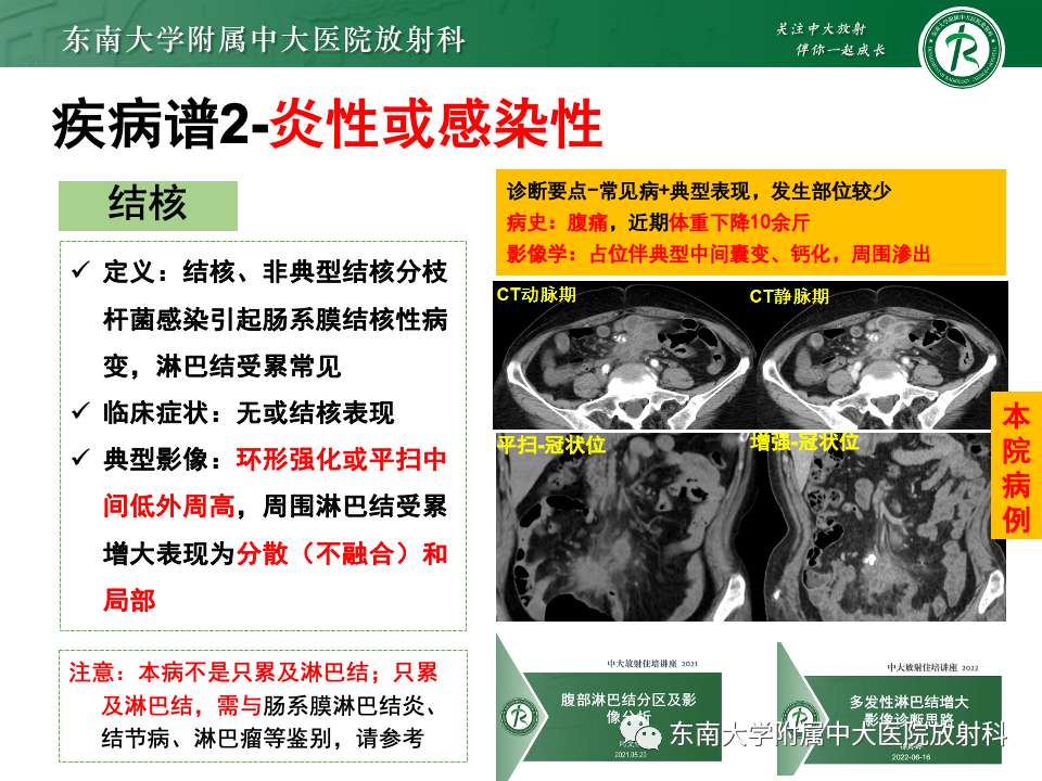 影像PPT - 【PPT】肠系膜区占位病例随访-30