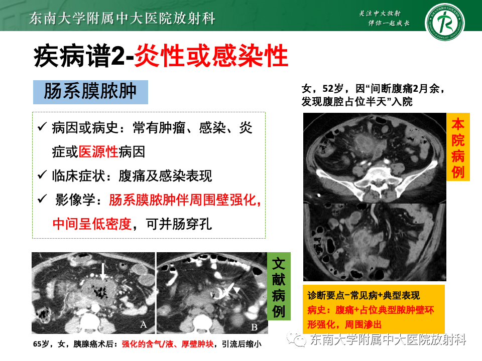 影像PPT - 【PPT】肠系膜区占位病例随访-31