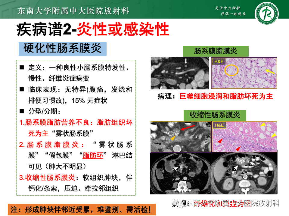 影像PPT - 【PPT】肠系膜区占位病例随访-32