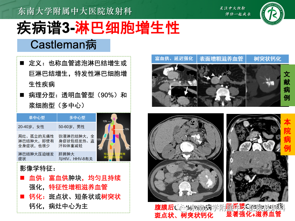 影像PPT - 【PPT】肠系膜区占位病例随访-33