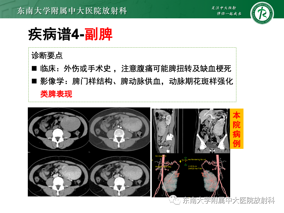 影像PPT - 【PPT】肠系膜区占位病例随访-34