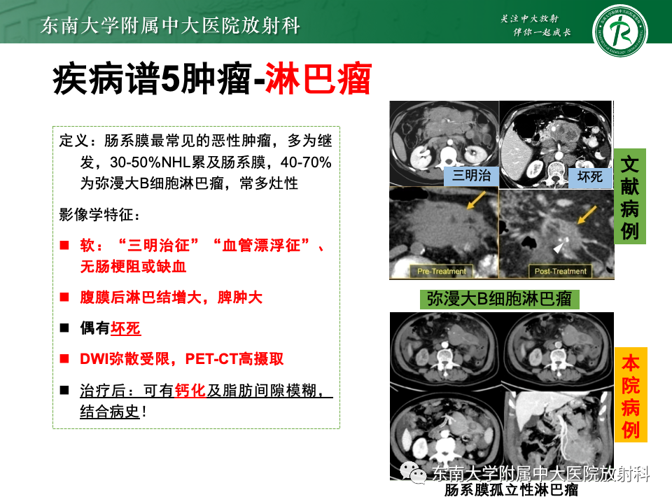 影像PPT - 【PPT】肠系膜区占位病例随访-37
