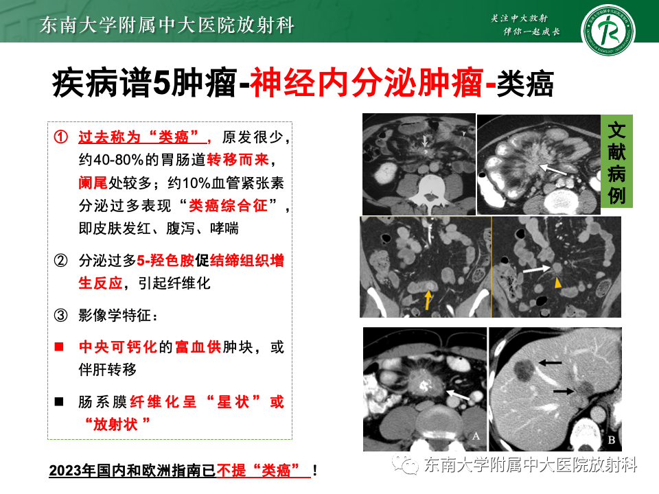影像PPT - 【PPT】肠系膜区占位病例随访-38