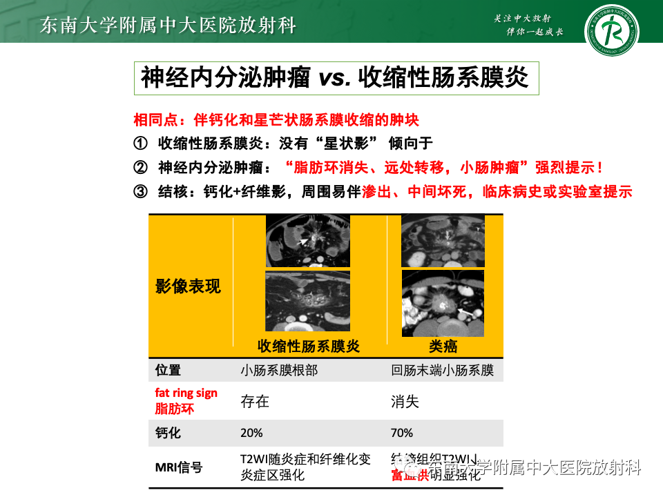 影像PPT - 【PPT】肠系膜区占位病例随访-39