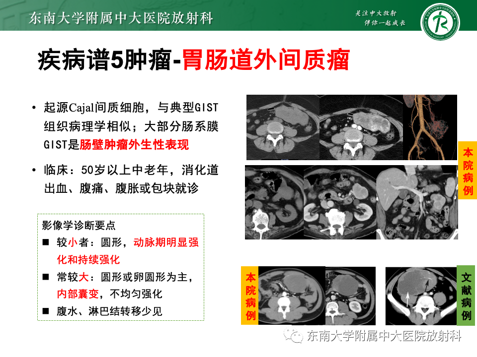 影像PPT - 【PPT】肠系膜区占位病例随访-40