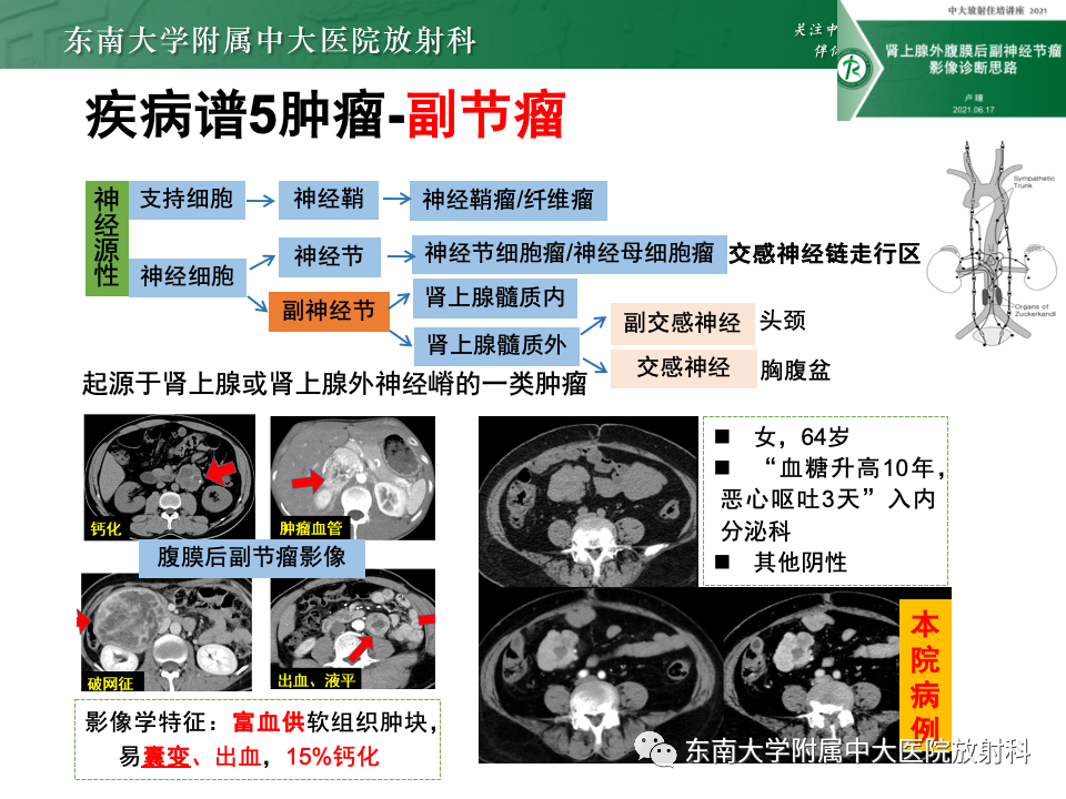 影像PPT - 【PPT】肠系膜区占位病例随访-41
