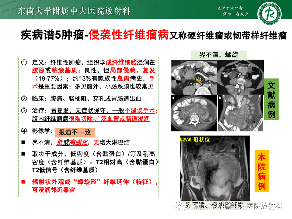 影像PPT - 【PPT】肠系膜区占位病例随访-42