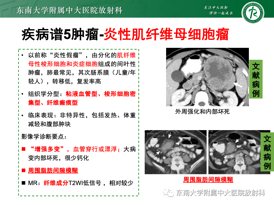 影像PPT - 【PPT】肠系膜区占位病例随访-45
