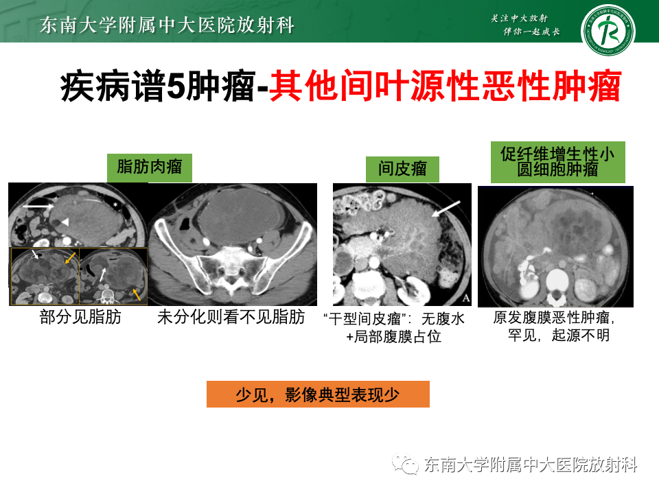 影像PPT - 【PPT】肠系膜区占位病例随访-47