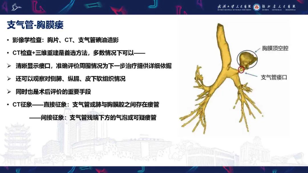 影像PPT - 【PPT】胸膜瘘影像诊断-5