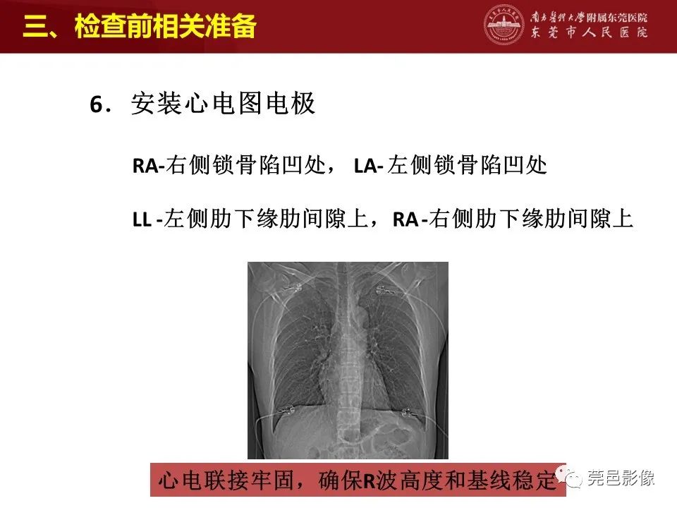 影像PPT - 【PPT】胸痛三联征CT扫描技术-15