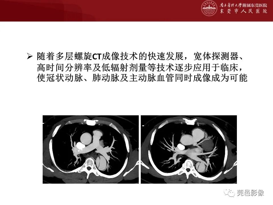 影像PPT - 【PPT】胸痛三联征CT扫描技术-17
