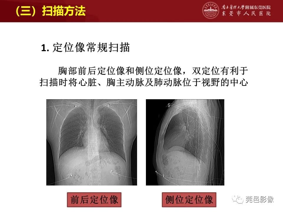影像PPT - 【PPT】胸痛三联征CT扫描技术-20