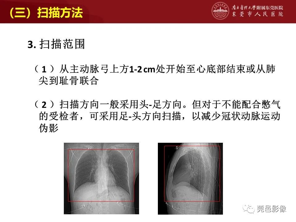 影像PPT - 【PPT】胸痛三联征CT扫描技术-22